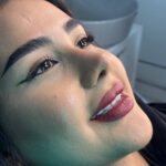جراحی بینی8