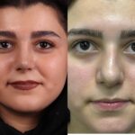 لیفت4