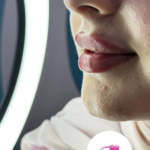 lip Filler Injections